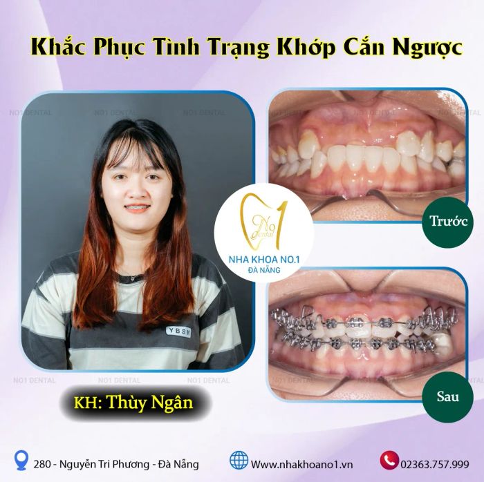 Nha Khoa NO1 Đà Nẵng ảnh 1