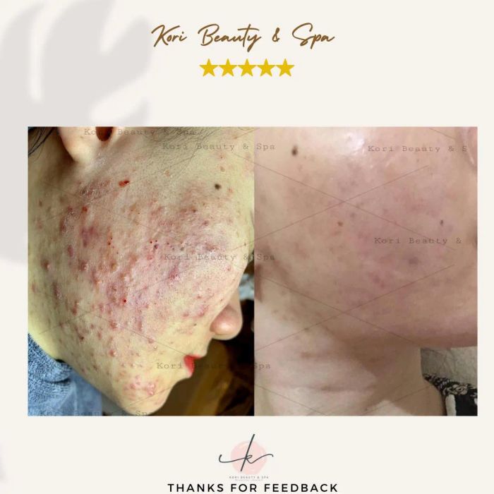 Hình ảnh không gian trị liệu đẳng cấp tại Kori Beauty & Spa