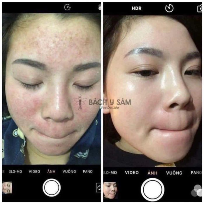 Khu vực điều trị chuyên nghiệp tại Phương Spa