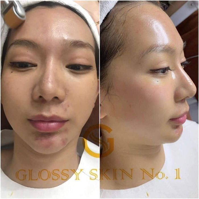 Trải nghiệm trị liệu thảo dược tại Bông Beauty Spa