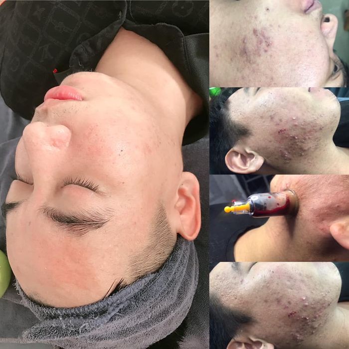 Thùy Spa - Trải nghiệm dịch vụ chăm sóc sắc đẹp chuyên nghiệp