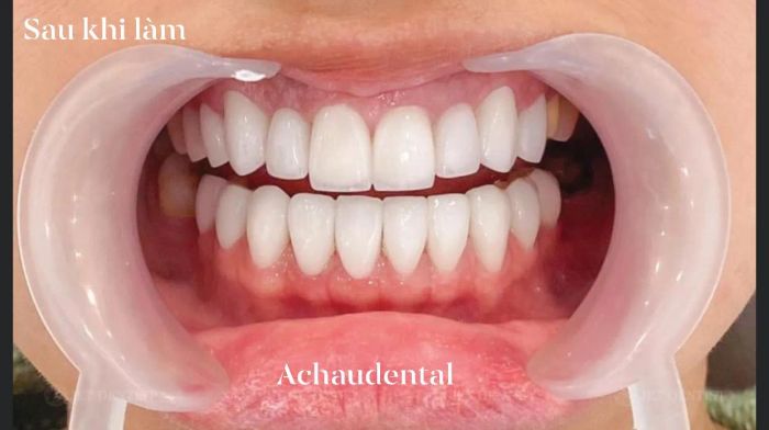Nha Khoa Thẩm Mỹ Á Châu ảnh 1