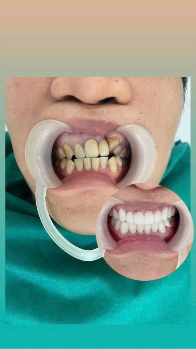 Nha khoa Thẩm mỹ Quốc tế City Dental ảnh 2