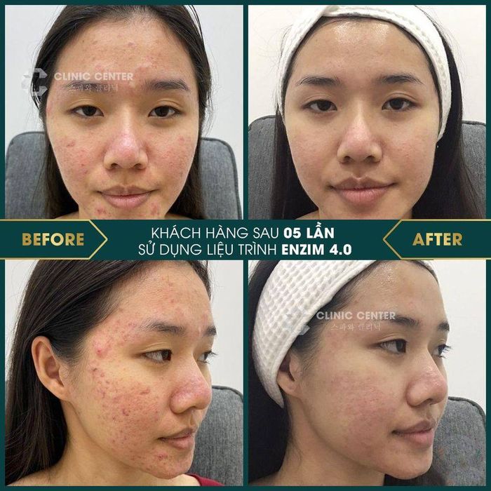 Trải nghiệm công nghệ cao tại C Spa & Clinic