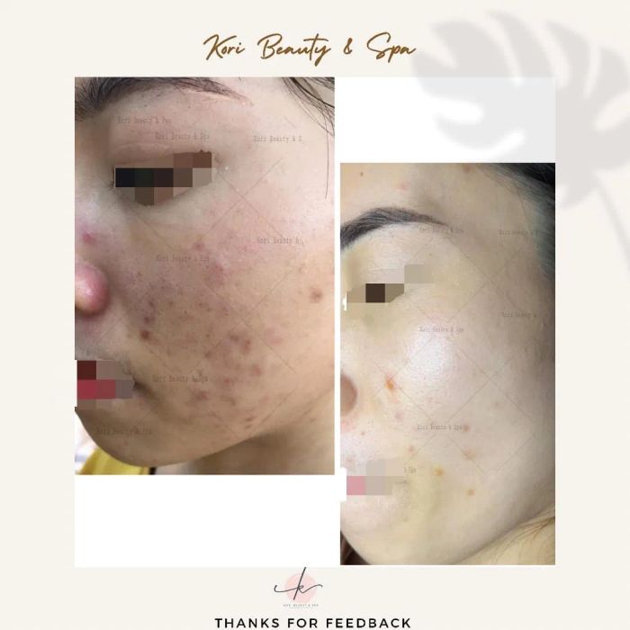 Hình ảnh không gian sang trọng tại Kori Beauty & Spa