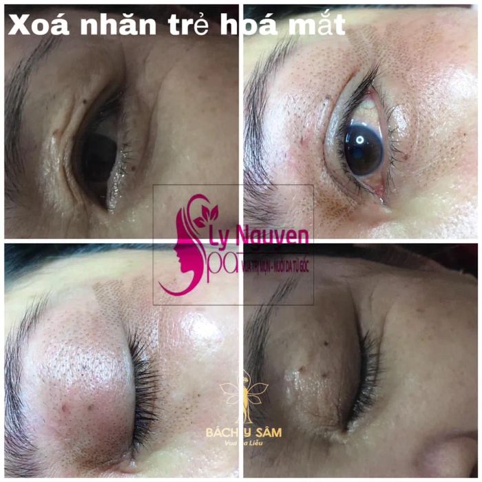 Khu vực điều trị chuyên nghiệp tại Ly Nguyễn Beauty Spa