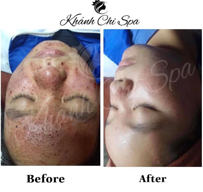 Không gian chăm sóc da chuyên nghiệp tại Khánh Chi Spa