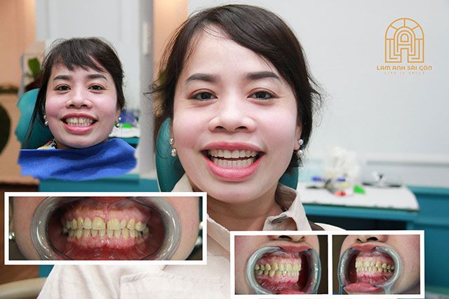Top địa chỉ nha khoa chuẩn quốc tế tại TP Tây Ninh