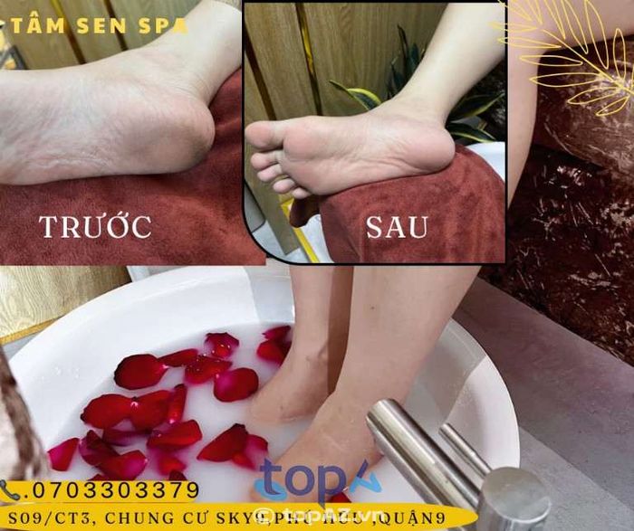 Spa chăm sóc gót chân Tâm Sen Spa tại Quận 9