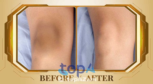 Thẩm mỹ viện Beryl tại TPHCM – Nơi giúp bạn sở hữu làn da mịn màng, tươi sáng