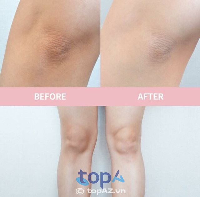 Sen Beauty tại TPHCM – Địa chỉ làm đẹp uy tín