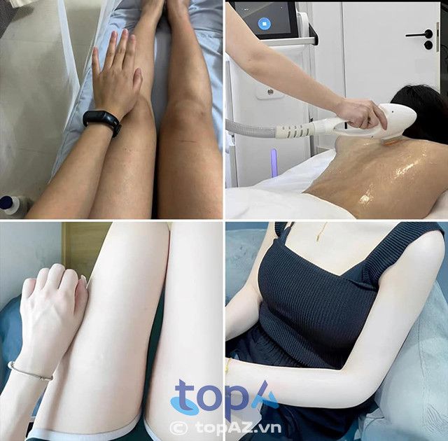 Phòng khám da liễu HT Beauty tại TPHCM – Nơi gửi gắm niềm tin sắc đẹp