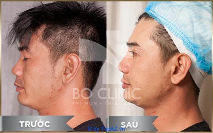 địa chỉ spa chăm sóc da mặt nam uy tín tại TP.HCM
