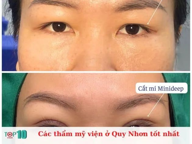 Danh sách thẩm mỹ viện chất lượng nhất Quy Nhơn