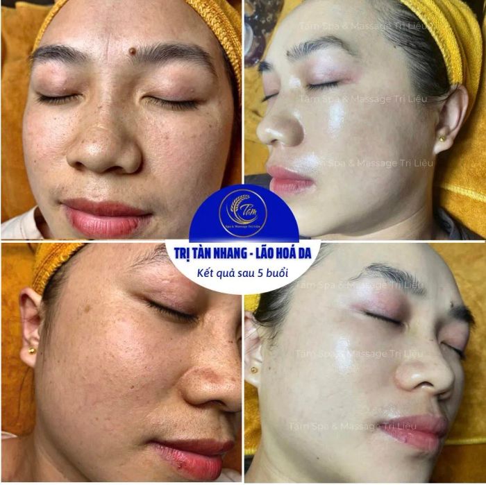 Hình ảnh Tấm Spa 1