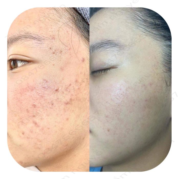 Hình ảnh Thắm Spa