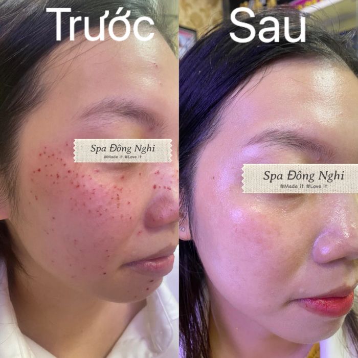 Hình ảnh Spa Đông Nghi 2
