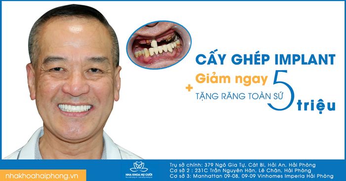 Hình ảnh Nha Khoa Nụ Cười Hải Phòng