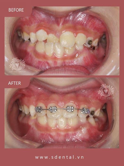 Hình ảnh S-Dental Nha Khoa Đặng Xá 2