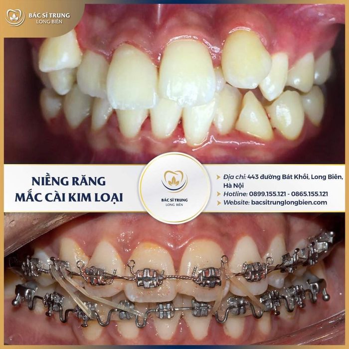 Hình ảnh Nha Khoa Phố Sủi