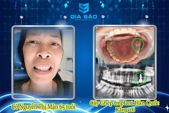 Hệ thống trang thiết bị tân tiến tại Nha khoa Gia Bảo
