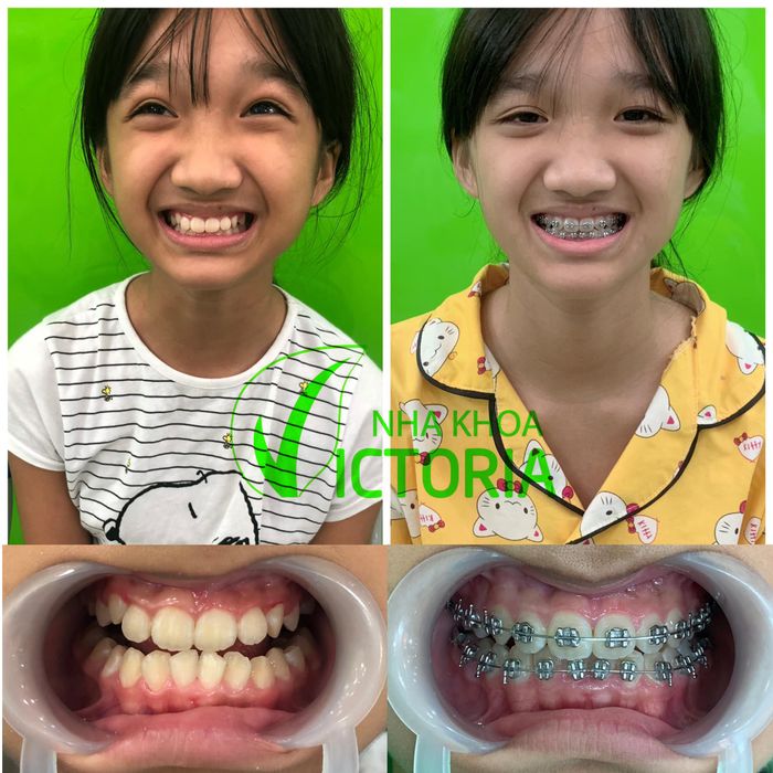 Hình ảnh Nha Khoa Victoria Gia Lâm