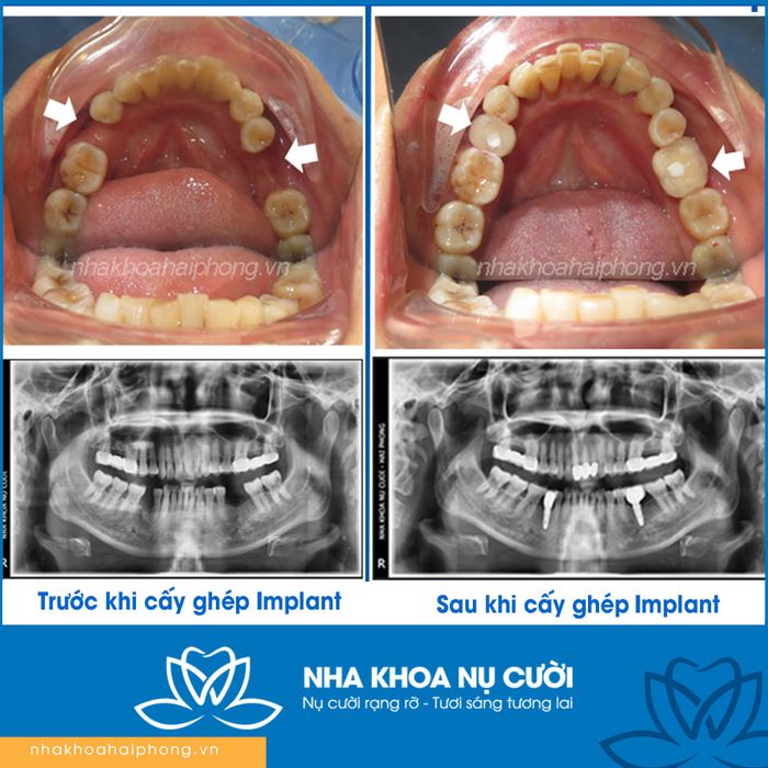 Hình ảnh thực tế Nha Khoa Nụ Cười Hải Phòng