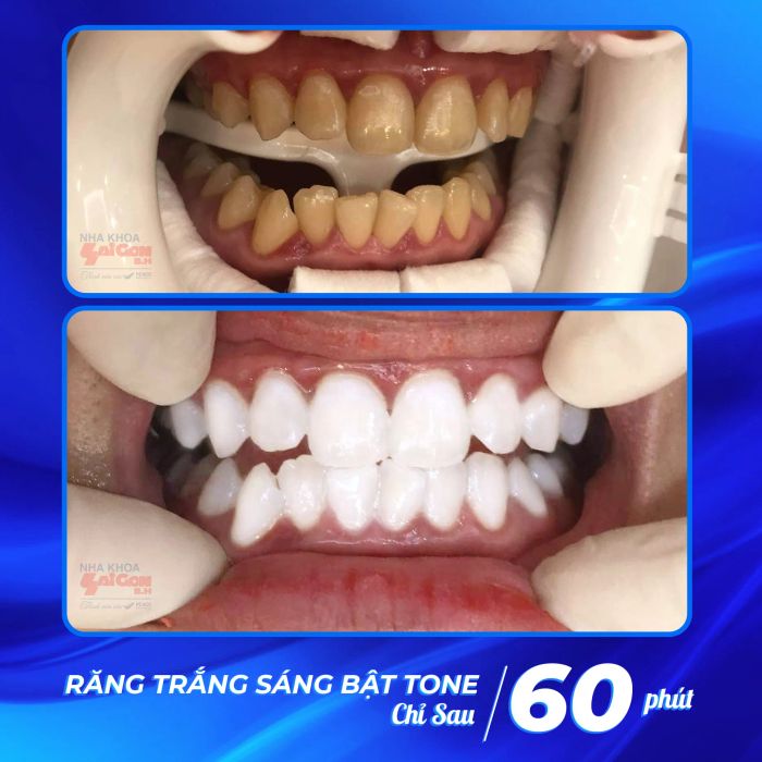 Hình ảnh phòng khám tiêu chuẩn tại Nha Khoa Sài Gòn B.H - Hố Nai