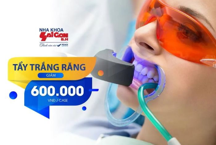 Hình ảnh quy trình tẩy trắng răng chuyên nghiệp tại Nha Khoa Sài Gòn B.H - Hố Nai
