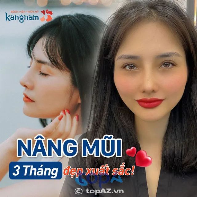 Viện Thẩm mỹ Kangnam Cần Thơ - Địa chỉ uy tín cho những ai mong muốn có dáng mũi đẹp tự nhiên, an toàn và chất lượng.