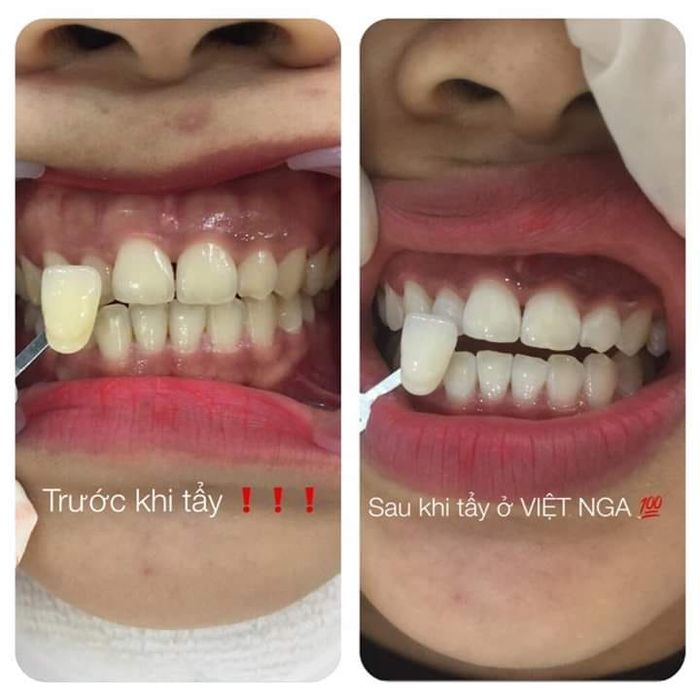 Hình ảnh trực quan về Nha Khoa Việt Nga - Không gian hiện đại đạt chuẩn y khoa