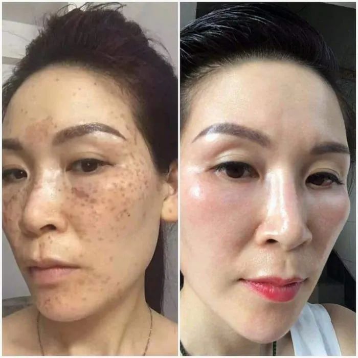 Lyna's Spa - Không gian thẩm mỹ chuẩn 5 sao - Ảnh 1