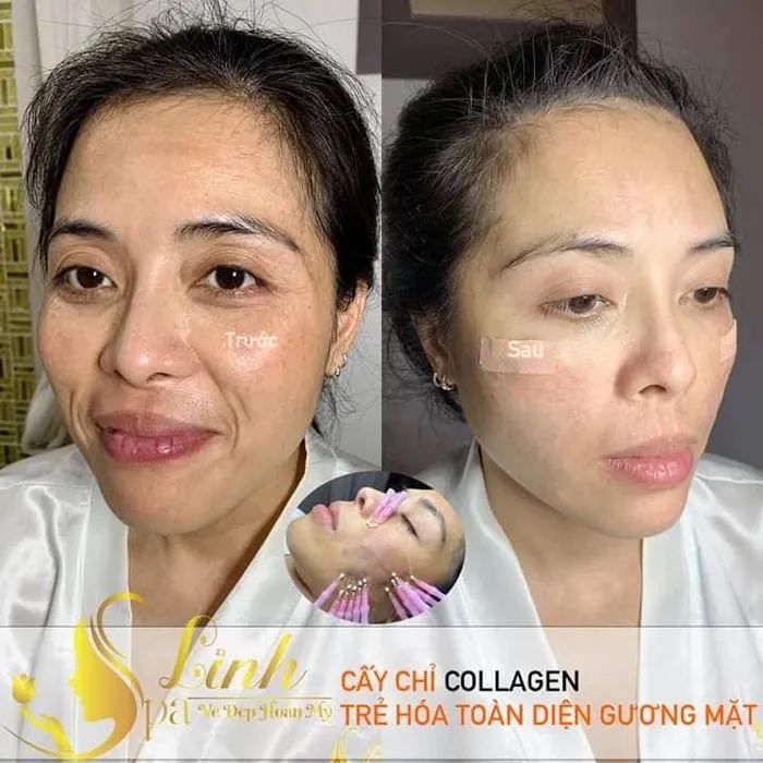 Linh Spa - Địa chỉ làm đẹp uy tín tại Quận 6 - Ảnh 1