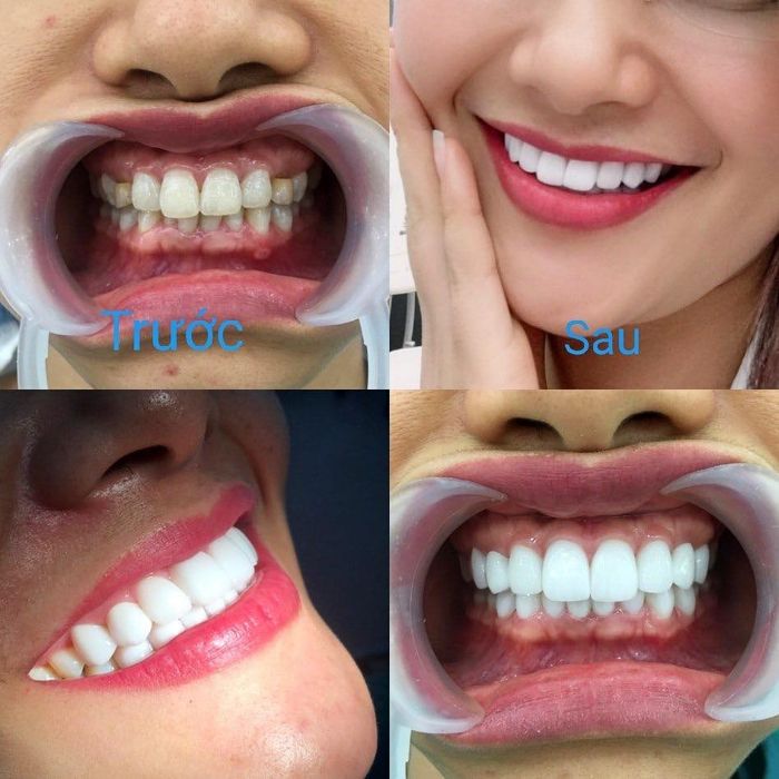 Không gian hiện đại tại Nha Khoa Vạn Thành - Nơi trao gửi nụ cười rạng rỡ