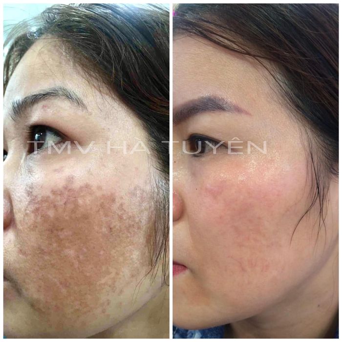 Thẩm Mỹ Viện Hà Tuyên hình ảnh 2