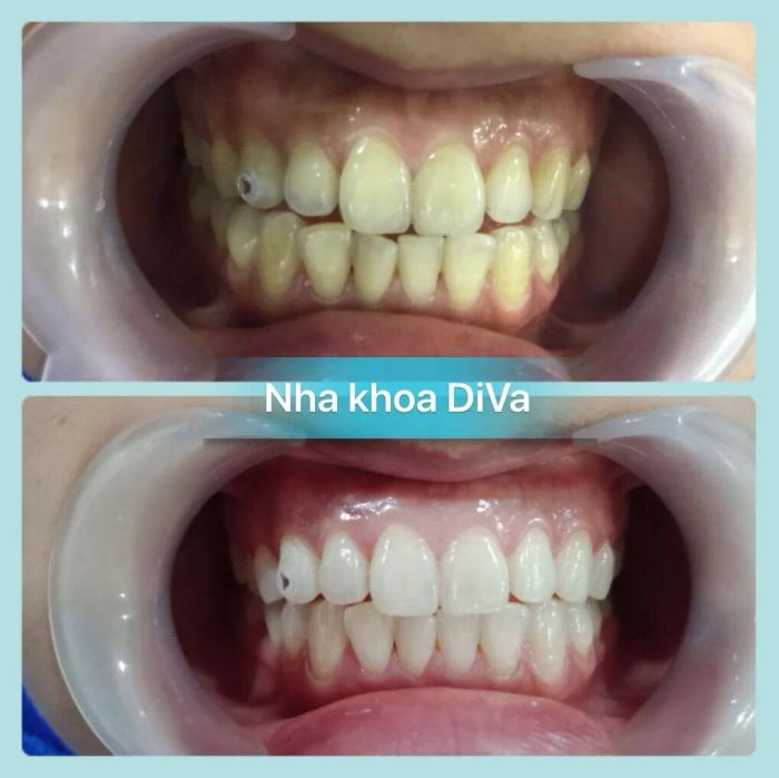 Hình ảnh Nha Khoa DIVA Hải Dương