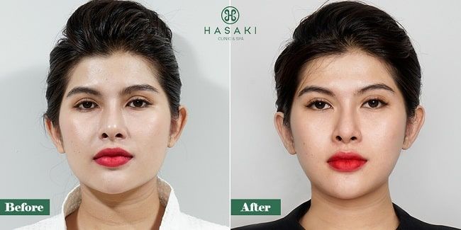 Hasaki Clinic & Spa - Địa chỉ vàng cho làn da căng bóng tại Phú Nhuận