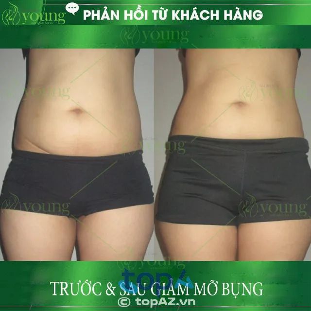 Young Spa & Clinic - Điểm đến vàng cho sắc đẹp toàn diện