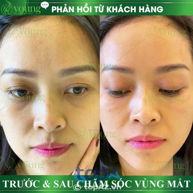 Young Spa & Clinic - Địa chỉ làm đẹp uy tín bậc nhất Sài Thành