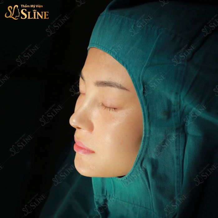 Khách hàng hài lòng sau khi nâng mũi tại Sline