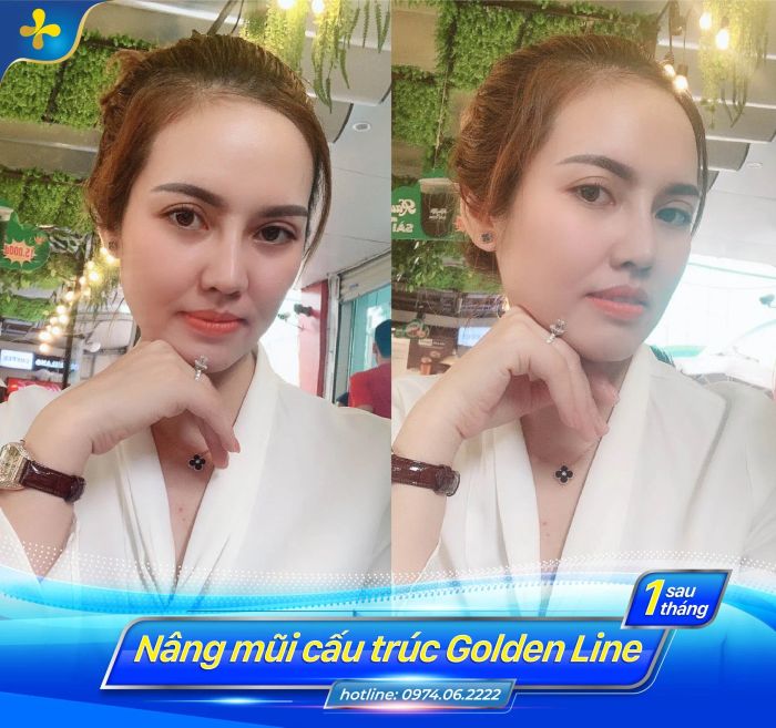 Hình ảnh thực tế về Thẩm mỹ Như Hoa - TS. Tống Hải