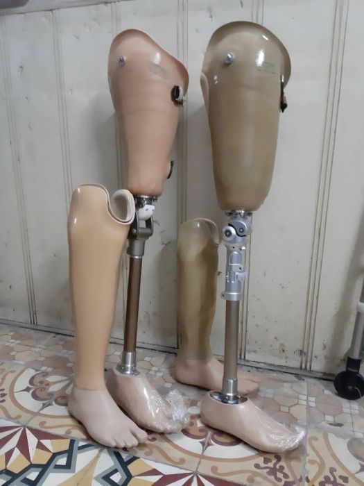 Xưởng Chỉnh Hình Chân Tay Giả Thảo Nguyên Hình Ảnh 1