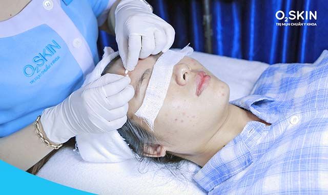 Top địa chỉ spa trị mụn uy tín nhất Cần Thơ