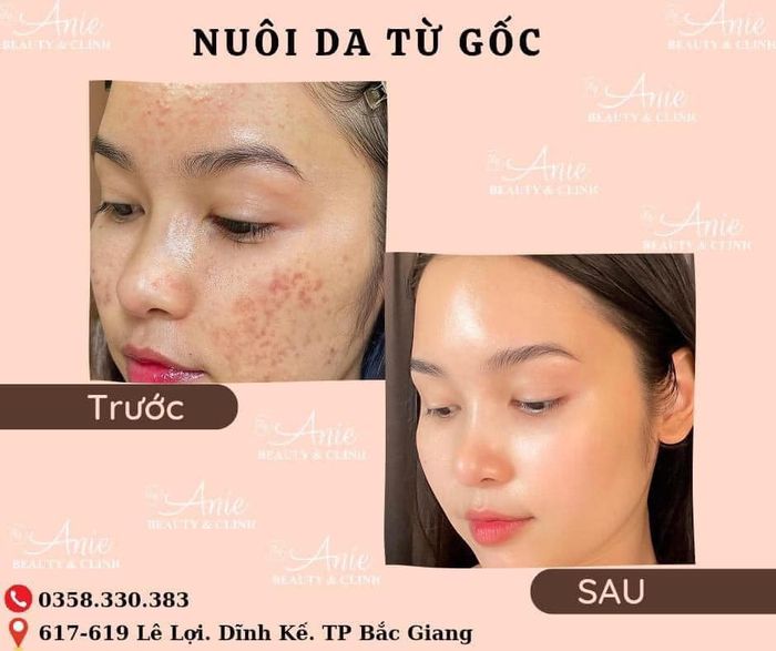 Hình ảnh Anie Beauty & Clinic - Không gian chăm sóc sắc đẹp tiêu chuẩn 5 sao