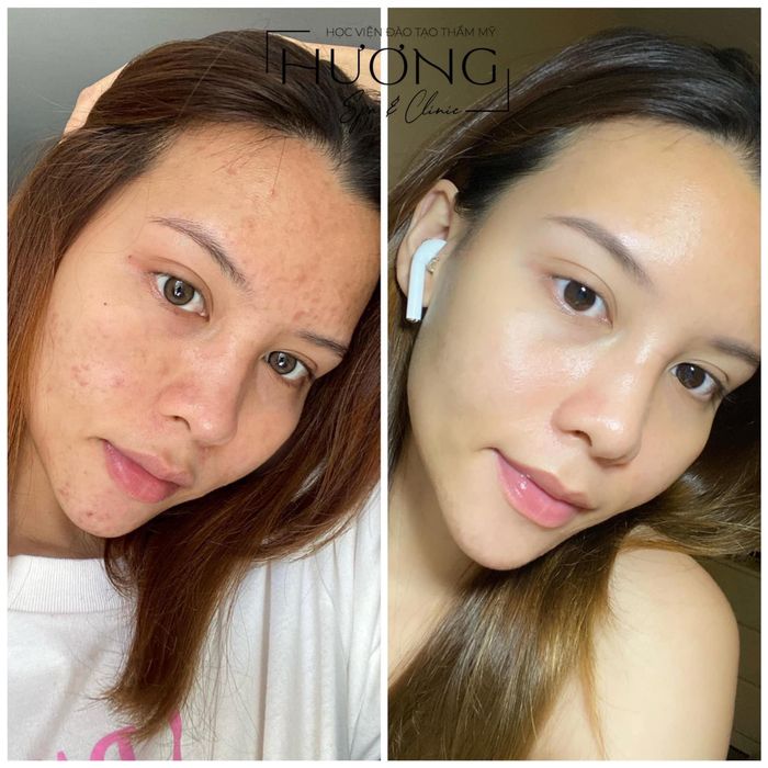Hình ảnh Hương Spa & Clinic - Góc thư giãn đẳng cấp với view tuyệt đẹp