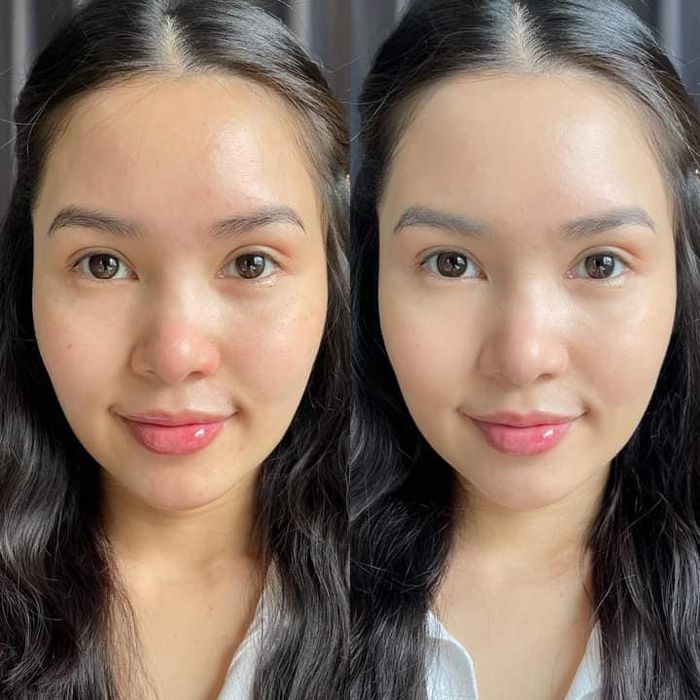 Hình ảnh Thẩm Mỹ Viện ALISA - Không gian chăm sóc sắc đẹp đẳng cấp