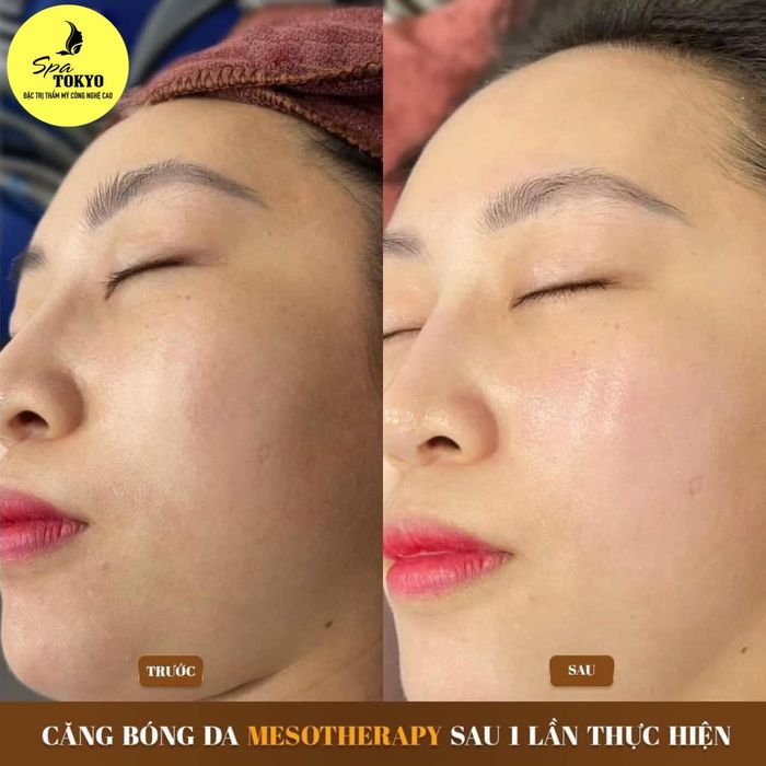 Hình ảnh Spa Tokyo - Không gian chuẩn Nhật thanh lịch