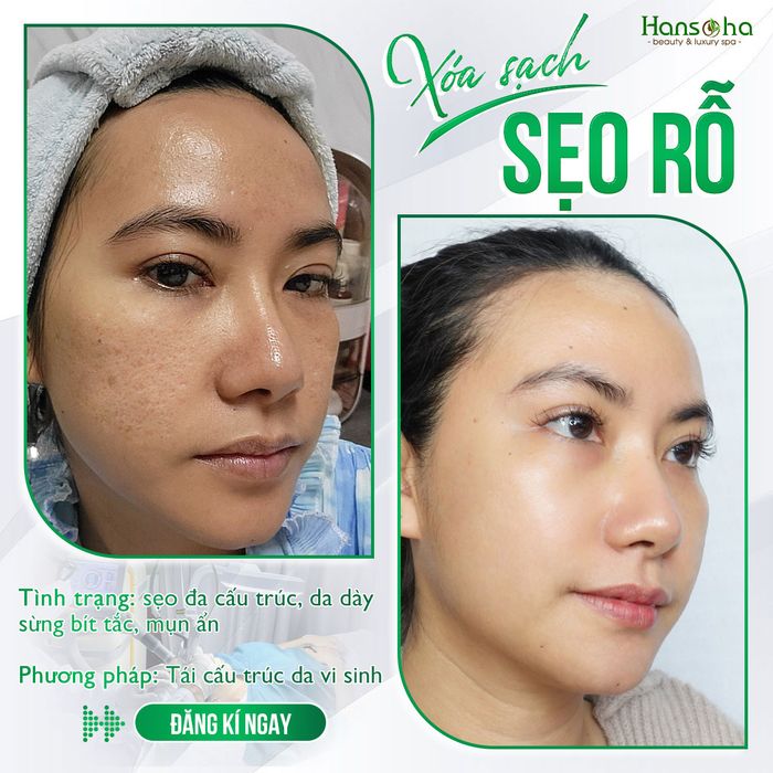 Hình ảnh Viện Thẩm Mỹ Quốc Tế Hansoha - Phòng điều trị hiện đại với công nghệ tiên tiến