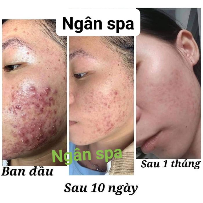 Ngân Spa hình ảnh 1
