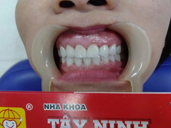 Hình ảnh phòng khám NHA KHOA TÂY NINH